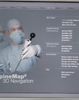 Stryker Navigation Systems II (MFG 2011)