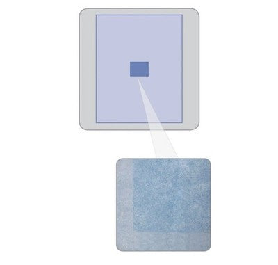 Medline Invisishield Ophthalmic Incise Drape DYNJSD1060 Sterile – Box of 10