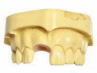 Training Model Upper Jaw ANA-4 TOKJ VG 902 Two Sites