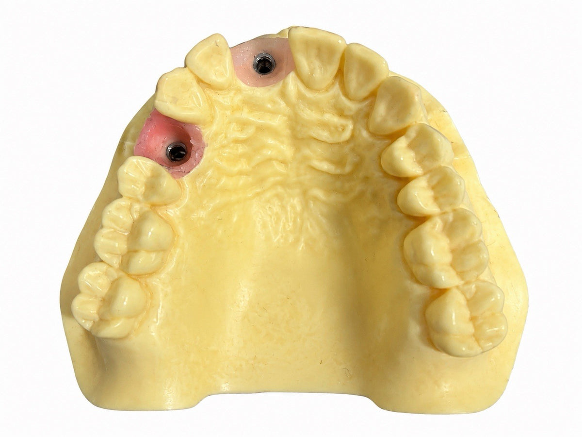 Training Model Upper Jaw ANA-4 TOKJ VG 902 Two Sites
