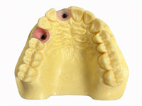 Training Model Upper Jaw ANA-4 TOKJ VG 902 Two Sites