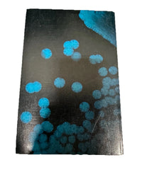 Gene Function in Prokaryotes Beckwith Davies Gallant 1983 Cold Spring Harbor